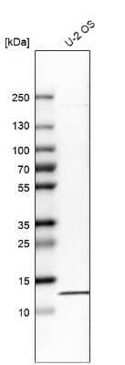 Western Blot: RPA14 Antibody [NBP1-87141]