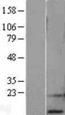 Western Blot: RPA14 Overexpression Lysate [NBL1-15490]