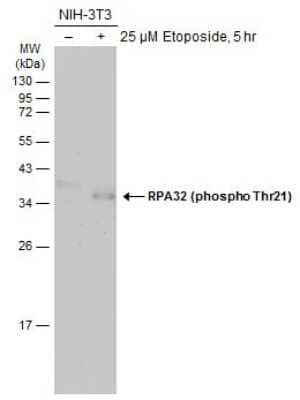 Western Blot: RPA2 [p Thr21] Antibody [NBP3-12924]