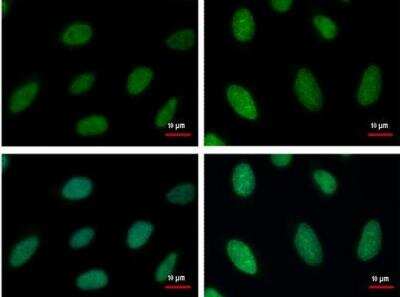 Immunocytochemistry/ Immunofluorescence: RPA2 Antibody (12F3.3) [NB100-158]