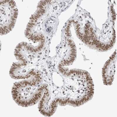 Immunohistochemistry-Paraffin: RPA2 Antibody [NBP1-89524]