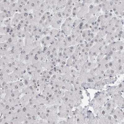 Immunohistochemistry-Paraffin: RPA2 Antibody [NBP1-89524]