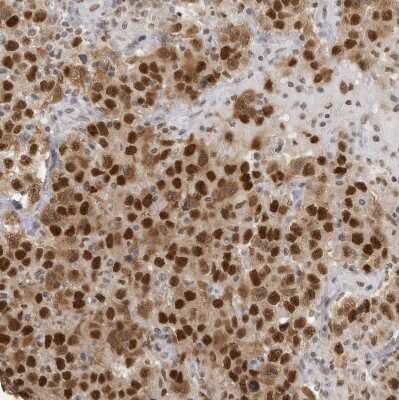 Immunohistochemistry-Paraffin: RPA2 Antibody [NBP1-89524]