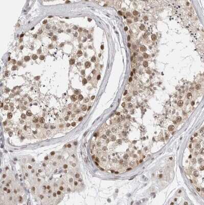 Immunohistochemistry-Paraffin: RPA2 Antibody [NBP1-89524]
