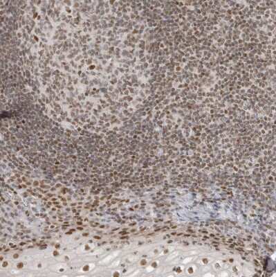 Immunohistochemistry-Paraffin: RPA2 Antibody [NBP1-89524]