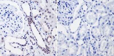 Immunohistochemistry-Paraffin: RPA2 Antibody (MA34) [NB100-74526]