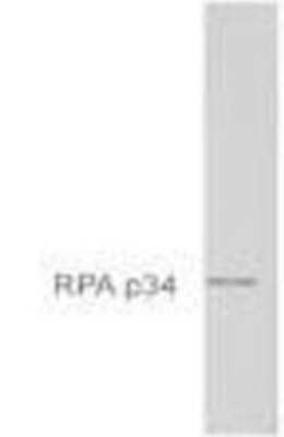 Western Blot: RPA2 Antibody (MA34) [NB100-74526]