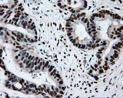 Immunohistochemistry: RPA2 Antibody (OTI9A1) - Azide and BSA Free [NBP2-73935]