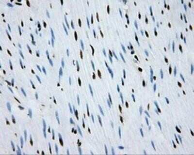 Immunohistochemistry: RPA2 Antibody (OTI9A1) - Azide and BSA Free [NBP2-73935]