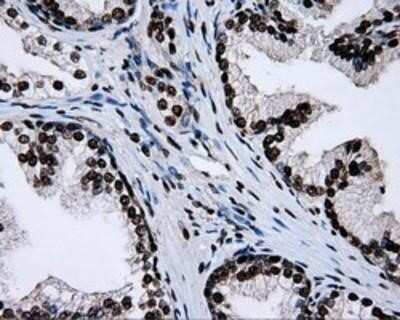 Immunohistochemistry: RPA2 Antibody (OTI9A1) - Azide and BSA Free [NBP2-73935]