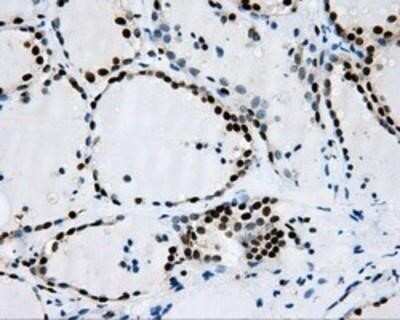 Immunohistochemistry: RPA2 Antibody (OTI9A1) - Azide and BSA Free [NBP2-73935]