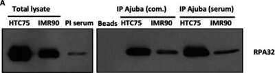 Western Blot: RPA2 Antibody (OTI9A1)Azide and BSA Free [NBP2-73935]