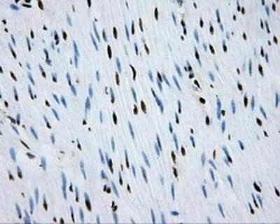 Immunohistochemistry-Paraffin: RPA2 Antibody (OTI9A1) [NBP2-02182]