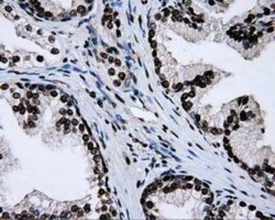 Immunohistochemistry-Paraffin: RPA2 Antibody (OTI9A1) [NBP2-02182]