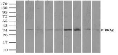 Immunoprecipitation: RPA2 Antibody (OTI9A1) [NBP2-02182]