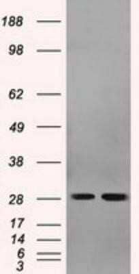 Western Blot: RPA2 Antibody (OTI9A1) [NBP2-02182]
