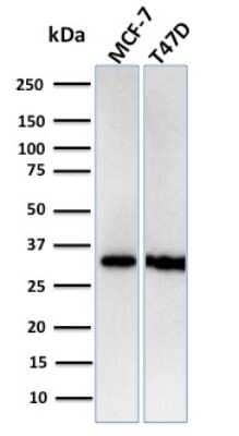 Western Blot: RPA2 Antibody (RPA2/3140R)Azide and BSA Free [NBP3-08330]