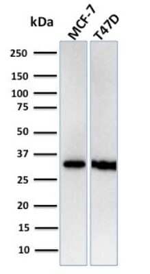 Western Blot: RPA2 Antibody (RPA2/3140R) [NBP3-07566]