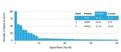 Protein Array: RPA2 Antibody (RPA2/4774) - Azide and BSA Free [NBP3-14167]