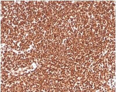 Immunohistochemistry-Paraffin: RPA2 Antibody (RPA2/4774) [NBP3-13764]