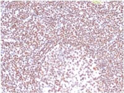 Immunohistochemistry-Paraffin: RPA2 Antibody (RPA2/4774) [NBP3-13764]