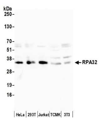 Western Blot: RPA2 Antibody [NB100-332]