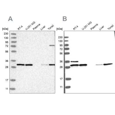 Western Blot: RPA2 Antibody [NBP1-89523]