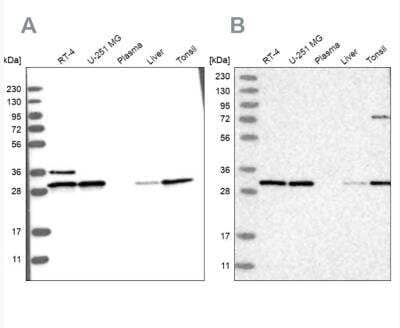 Western Blot: RPA2 Antibody [NBP1-89524]