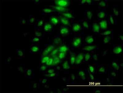 Immunocytochemistry/ Immunofluorescence: RPA4 Antibody [H00029935-B01P]