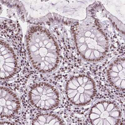 Immunohistochemistry: RPA4 Antibody [NBP2-49468]