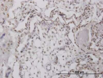 Immunohistochemistry-Paraffin: RPA4 Antibody [H00029935-B01P]