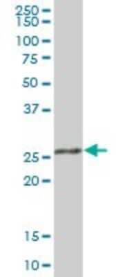 Western Blot: RPA4 Antibody [H00029935-B01P]