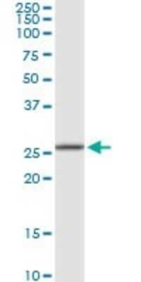 Western Blot: RPA4 Antibody [H00029935-D01P]