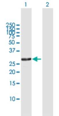 Western Blot: RPA4 Antibody [H00029935-D01P]