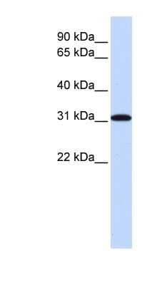 Western Blot: RPA4 Antibody [NBP1-58156]