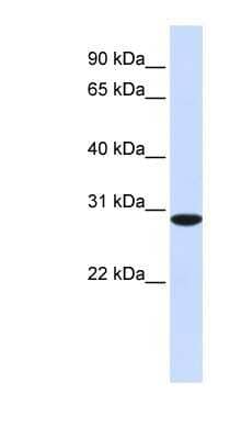 Western Blot: RPA4 Antibody [NBP1-58157]