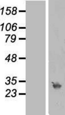 Western Blot: RPA4 Overexpression Lysate [NBL1-15491]