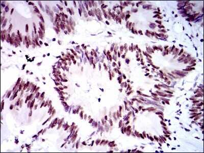 Immunohistochemistry: RPA70 Antibody (4C4) - BSA Free [NBP2-37500]