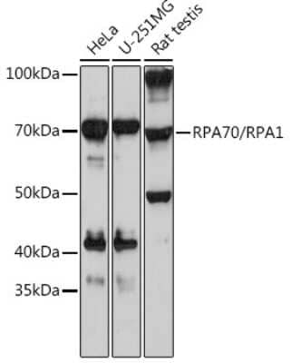 Western Blot: RPA70 Antibody (5R7S3) [NBP3-16174]