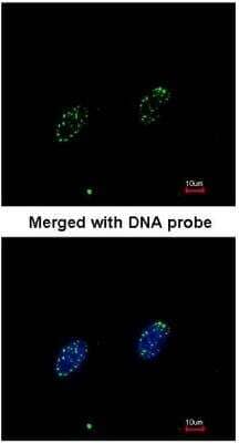 Immunocytochemistry/ Immunofluorescence: RPA70 Antibody [NBP1-31382]