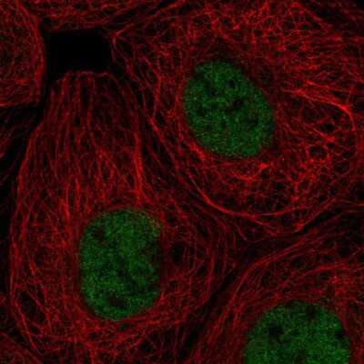Immunocytochemistry/ Immunofluorescence: RPA70 Antibody [NBP2-55485]