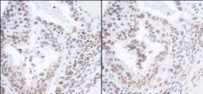 Immunohistochemistry-Paraffin: RPA70 Antibody [NB100-2204]