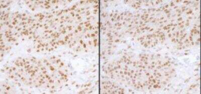 Immunohistochemistry-Paraffin: RPA70 Antibody [NB100-2204]