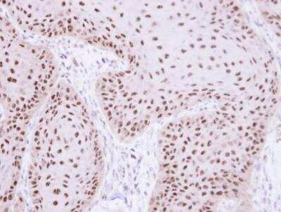 Immunohistochemistry-Paraffin: RPA70 Antibody [NBP1-31382]