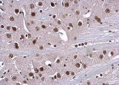 Immunohistochemistry-Paraffin: RPA70 Antibody [NBP1-31382]