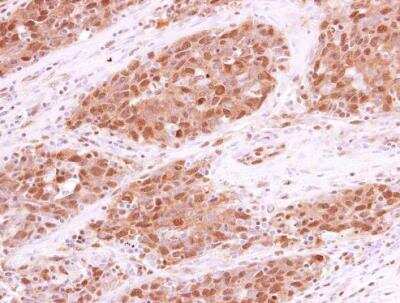 Immunohistochemistry-Paraffin: RPA70 Antibody [NBP1-31382]