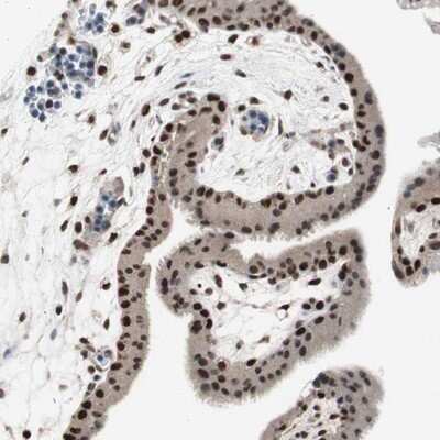 Immunohistochemistry-Paraffin: RPA70 Antibody [NBP1-89658]