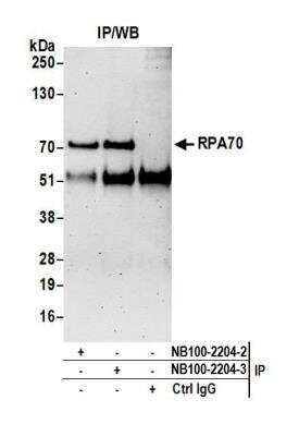 Immunoprecipitation: RPA70 Antibody [NB100-2204]