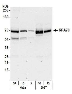 Western Blot: RPA70 Antibody [NB100-2204]