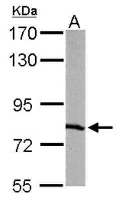 Western Blot: RPA70 Antibody [NBP1-31382]